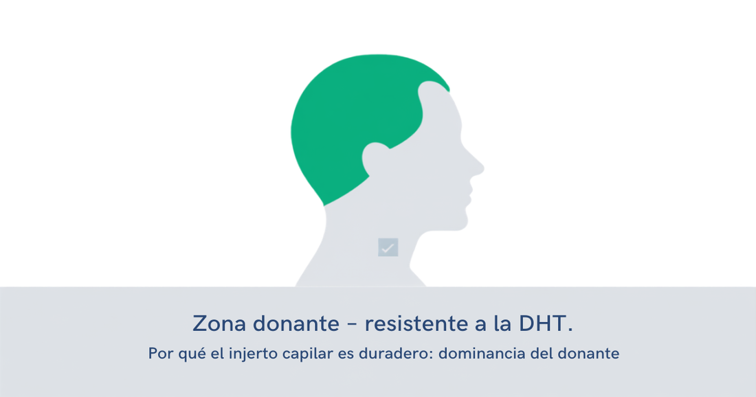 Diagrama de la zona donante del cuero cabelludo, resistente a la DHT, base biológica de la permanencia del implante capilar