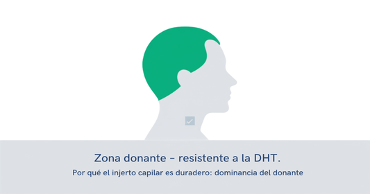 Diagrama de la zona donante del cuero cabelludo, resistente a la DHT, base biológica de la permanencia del implante capilar